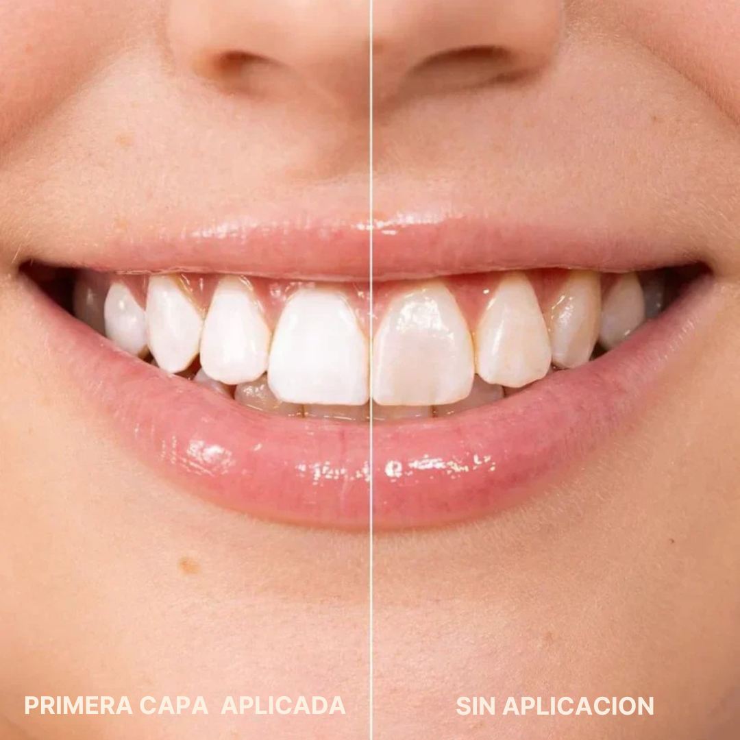 Blanqueador Dental Cosmético – Sonrisa Blanca en Segundos