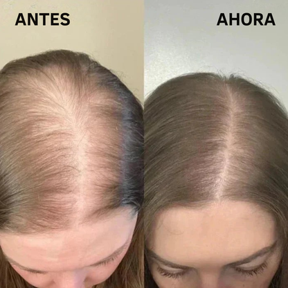 Champú de Romero 100% Orgánico – Estimula el Crecimiento del Cabello