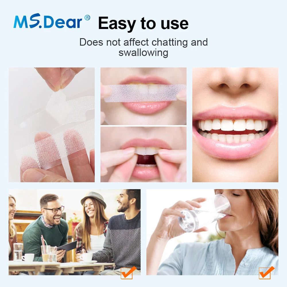 Tiras Blanqueadoras 9D para Sonrisas Radiantes