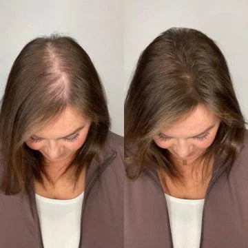 Champú de Romero 100% Orgánico – Estimula el Crecimiento del Cabello